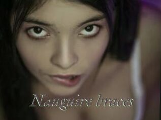 Nauguire_braces