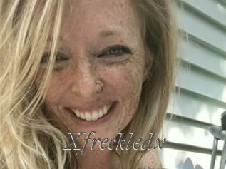 Xfreckledx